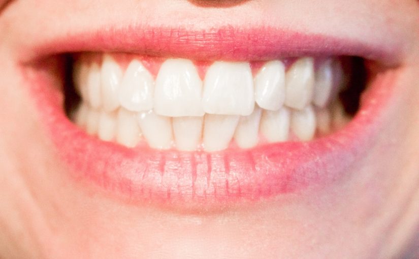 Dzisiejsza technika wykorzystywana w salonach stomatologii estetycznej zdoła sprawić, że odbierzemy śliczny uśmiech.